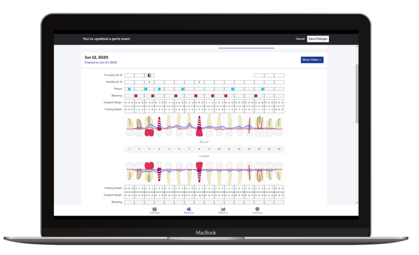 Добавление автоматизированной пародонтальной карты