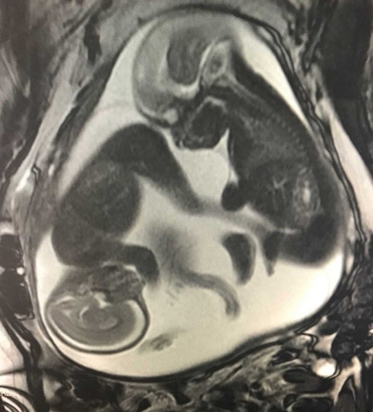 Файл:IMG 20211009 210417 273.jpg