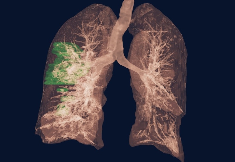 Файл:NVIDIA Clara 3.jpg